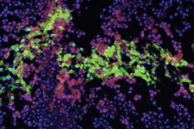 الأعضاء البشرية من الطابعة ثلاثية الأبعاد