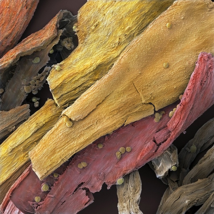 17 Alimentos que são espantosos ao microscópio