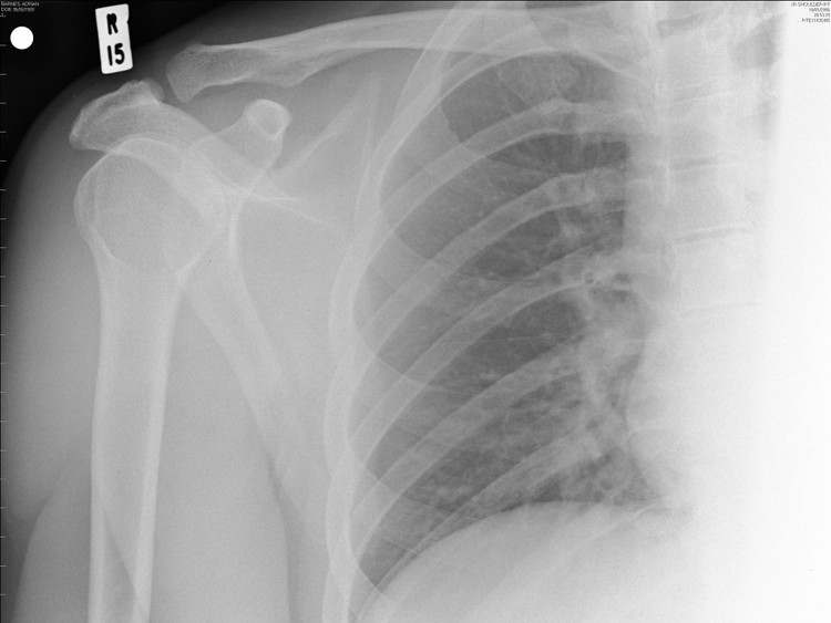 8 mutações genéticas que lhe podem dar “superpoderes”