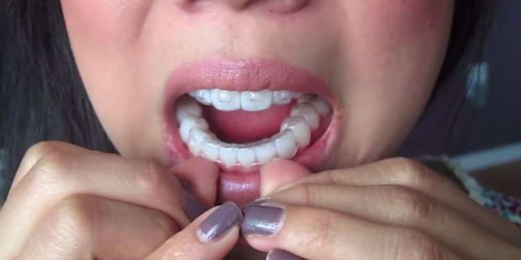 O que a Miss Universo ganha para além da coroa