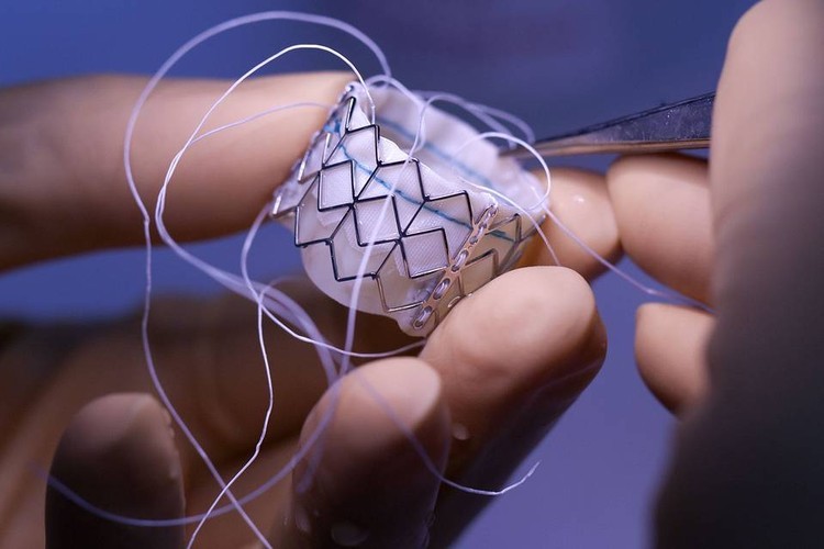 Que ações comprar?